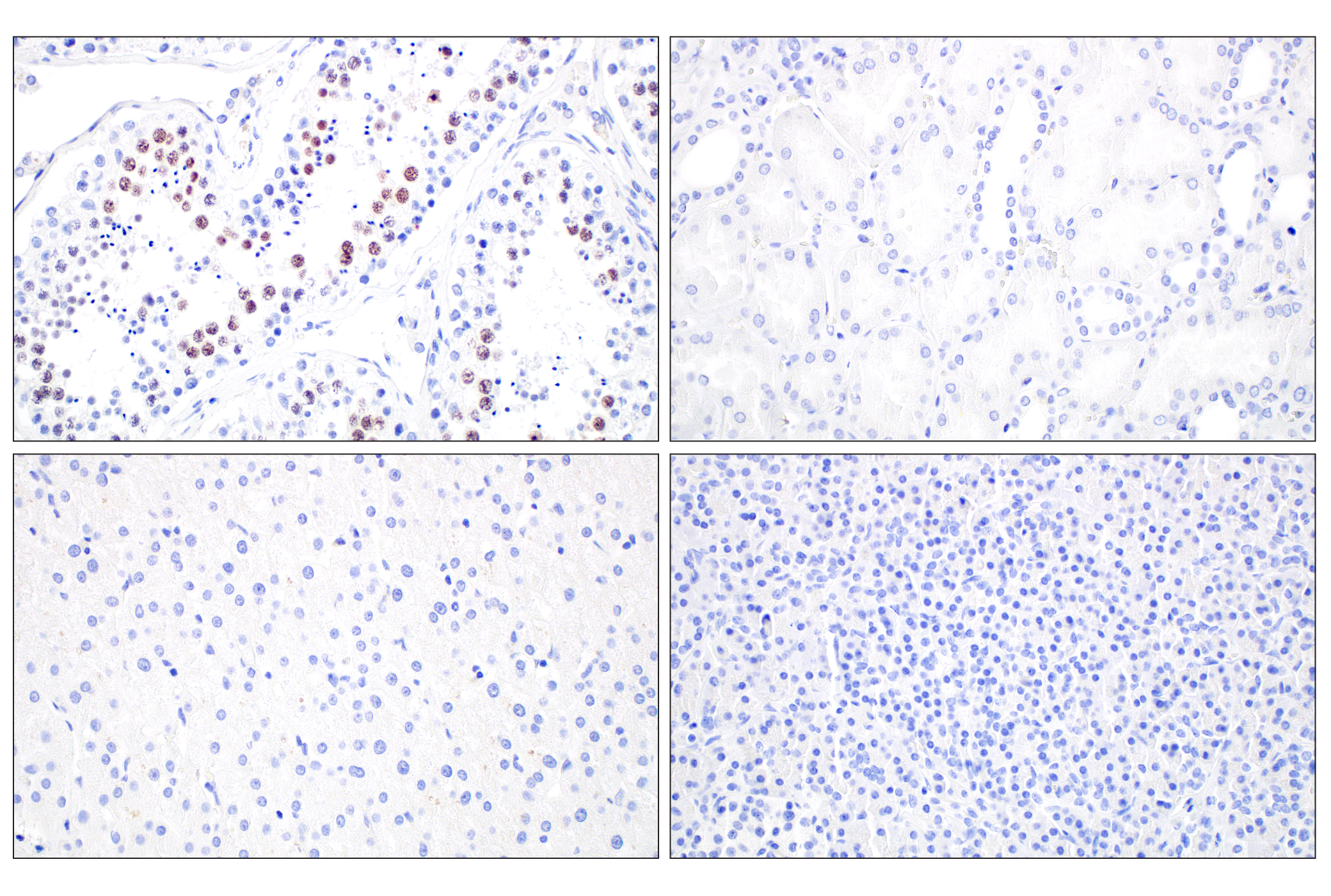 Immunohistochemistry Image 2: SGO2 (E9K4N) Rabbit mAb (BSA and Azide Free)