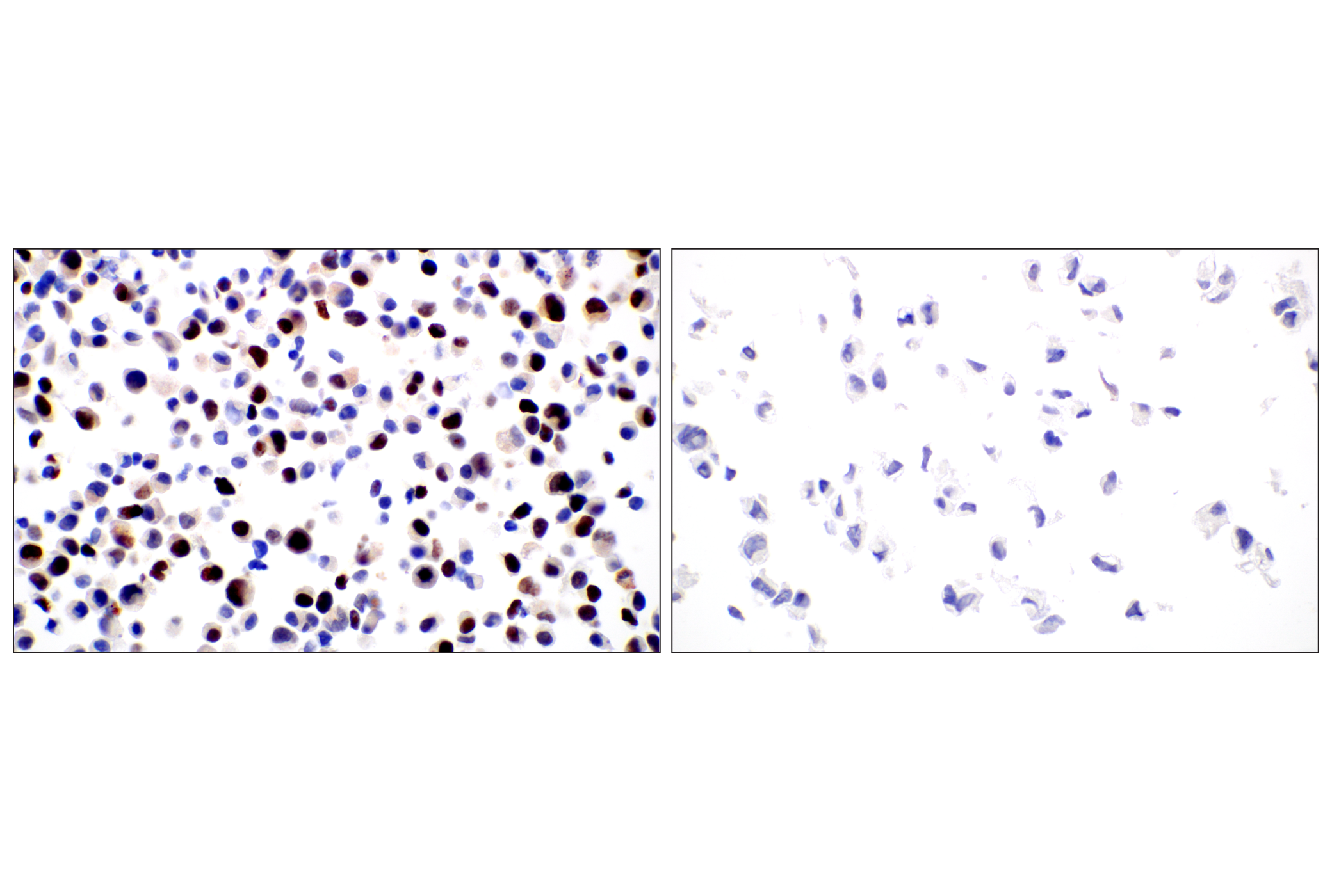 Immunohistochemistry Image 6: SGO2 (E9K4N) Rabbit mAb (BSA and Azide Free)