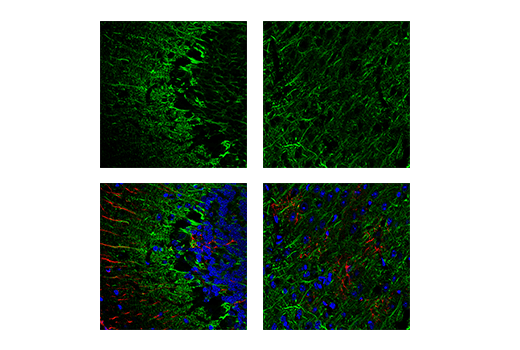 Immunofluorescence Image 1: Neurofilament-M Antibody