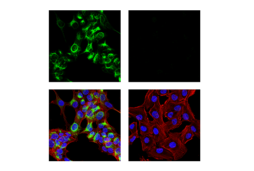 Immunofluorescence Image 2: Neurofilament-M Antibody