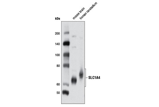 Western Blotting Image 1: SLC1A4 Antibody