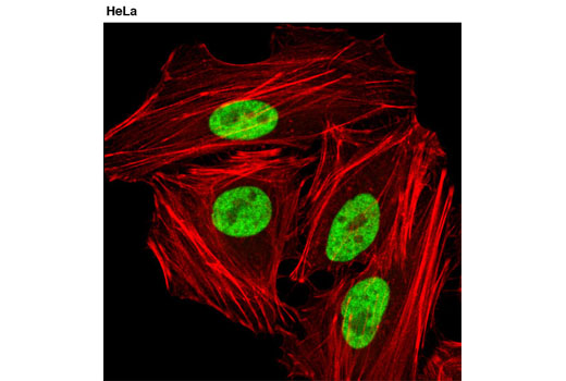 Immunofluorescence Image 1: hnRNP A1 (D21H11) Rabbit mAb