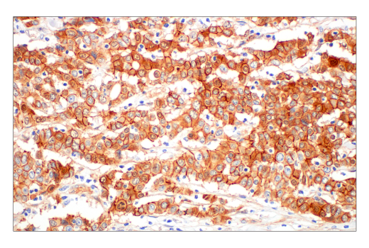 Immunohistochemistry Image 4: β-Catenin (D10A8) XP® Rabbit mAb (BSA and Azide Free)