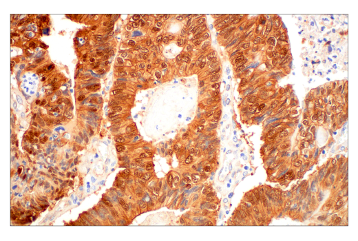 Immunohistochemistry Image 3: β-Catenin (D10A8) XP® Rabbit mAb (BSA and Azide Free)
