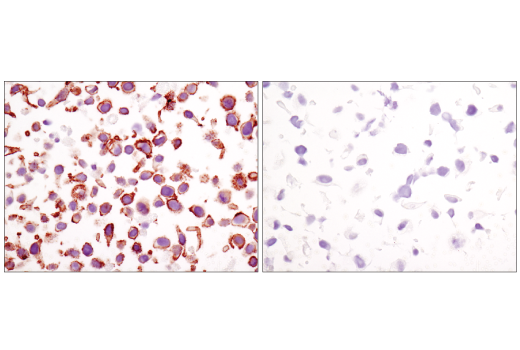 Immunohistochemistry Image 7: β-Catenin (D10A8) XP® Rabbit mAb (BSA and Azide Free)