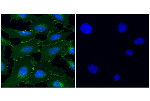 Immunofluorescence Image 1: β-Catenin (D10A8) XP® Rabbit mAb (BSA and Azide Free)