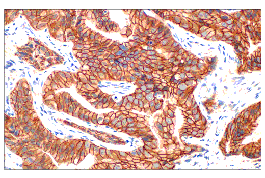 Immunohistochemistry Image 2: β-Catenin (D10A8) XP® Rabbit mAb (BSA and Azide Free)