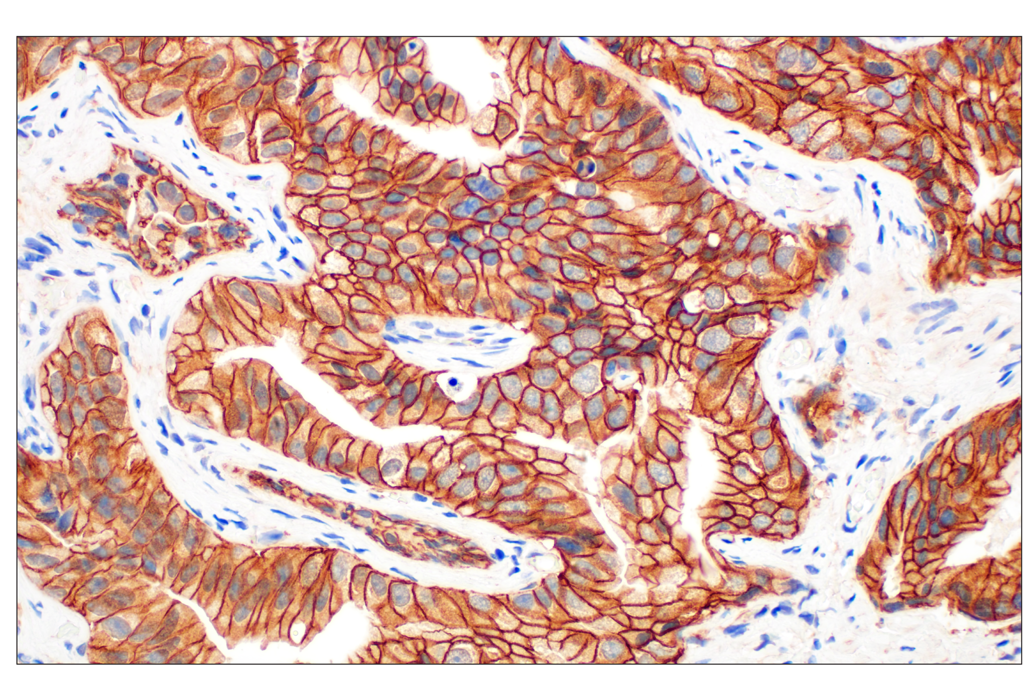 Immunohistochemistry Image 1: β-Catenin (D10A8) XP® Rabbit mAb (BSA and Azide Free)