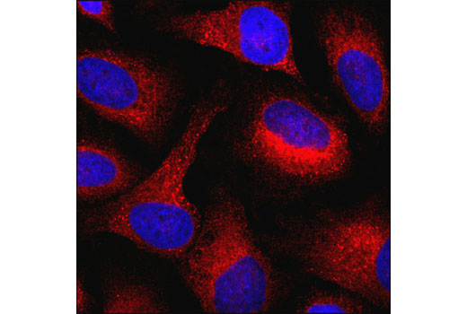 Immunofluorescence Image 1: PDI (C81H6) Rabbit mAb (Alexa Fluor® 555 Conjugate)