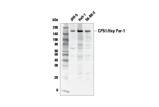Western Blotting Image 1: CPS1/Hep Par-1 Antibody