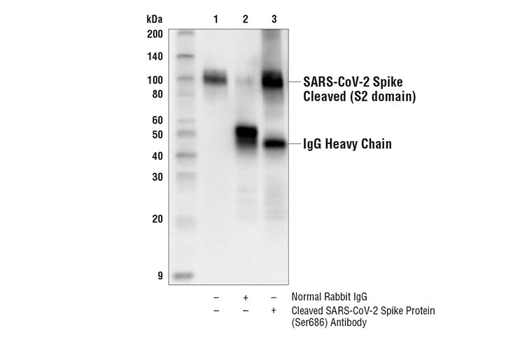 Immunoprecipitation Image 1: Cleaved SARS-CoV-2 Spike Protein (Ser686) Antibody