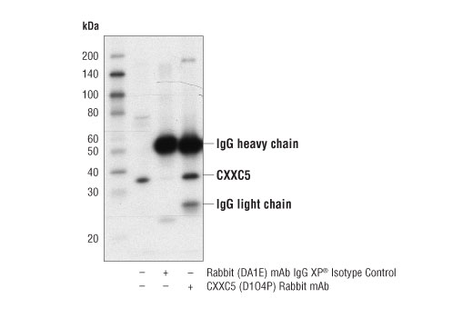 Immunoprecipitation Image 1: CXXC5 (D1O4P) Rabbit mAb