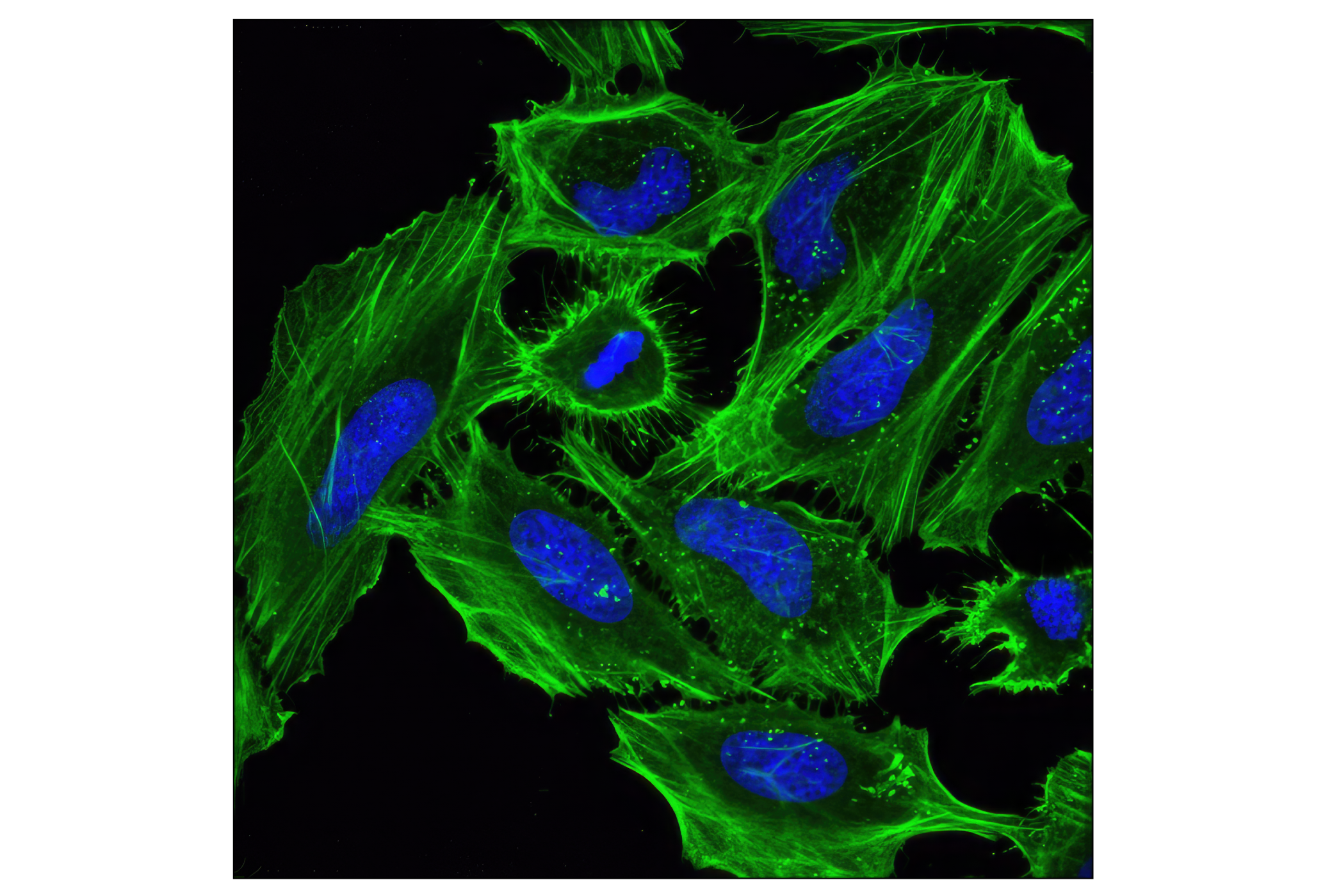 Immunofluorescence Image 1: β-Actin (D6A8) Rabbit mAb