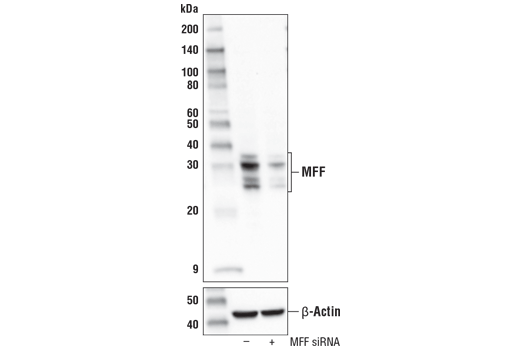  Image 8: Mitochondrial Dynamics Antibody Sampler Kit II