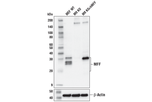  Image 15: Mitochondrial Dynamics Antibody Sampler Kit II