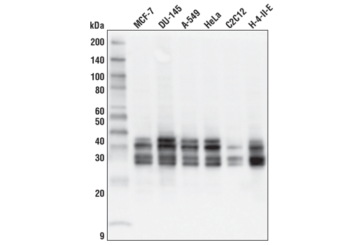  Image 22: Mitochondrial Dynamics Antibody Sampler Kit II
