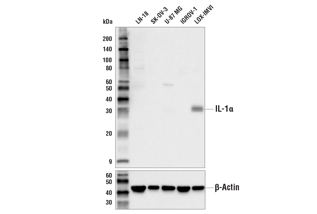 Western Blotting Image 1: IL-1α Antibody