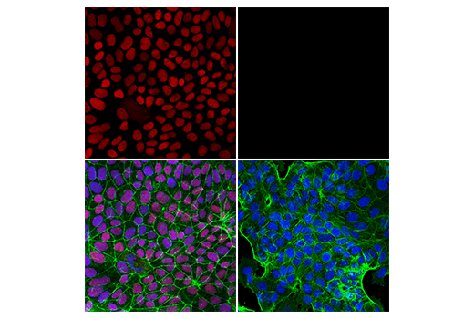 Immunofluorescence Image 1: CDX2 (D11D10) Rabbit mAb (Alexa Fluor® 555 Conjugate)