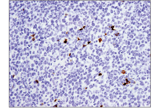 Immunohistochemistry Image 1: PD-1 (Intracellular Domain) (D7D5W) XP® Rabbit mAb