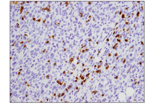 Immunohistochemistry Image 2: PD-1 (Intracellular Domain) (D7D5W) XP® Rabbit mAb
