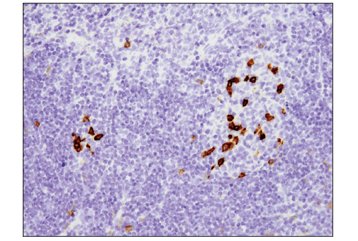 Immunohistochemistry Image 3: PD-1 (Intracellular Domain) (D7D5W) XP® Rabbit mAb