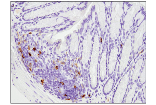 Immunohistochemistry Image 4: PD-1 (Intracellular Domain) (D7D5W) XP® Rabbit mAb