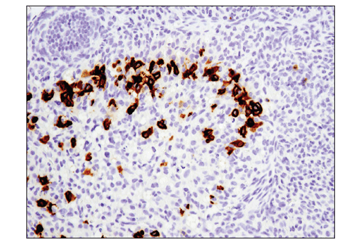 Immunohistochemistry Image 6: PD-1 (Intracellular Domain) (D7D5W) XP® Rabbit mAb