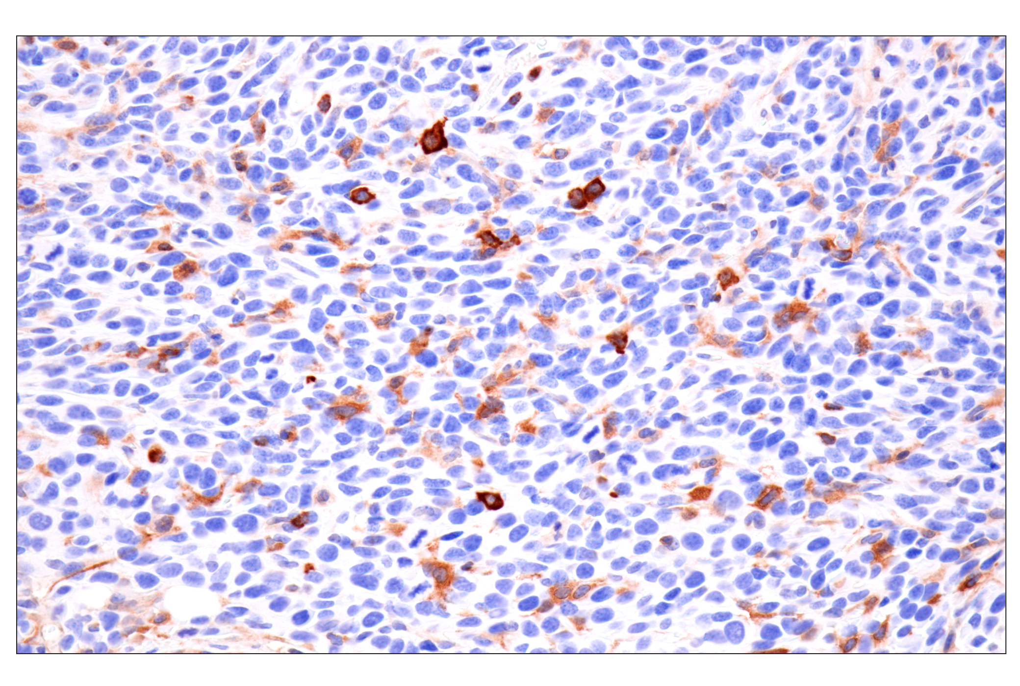 Immunohistochemistry Image 10: SPAK (F7T1K) Rabbit mAb