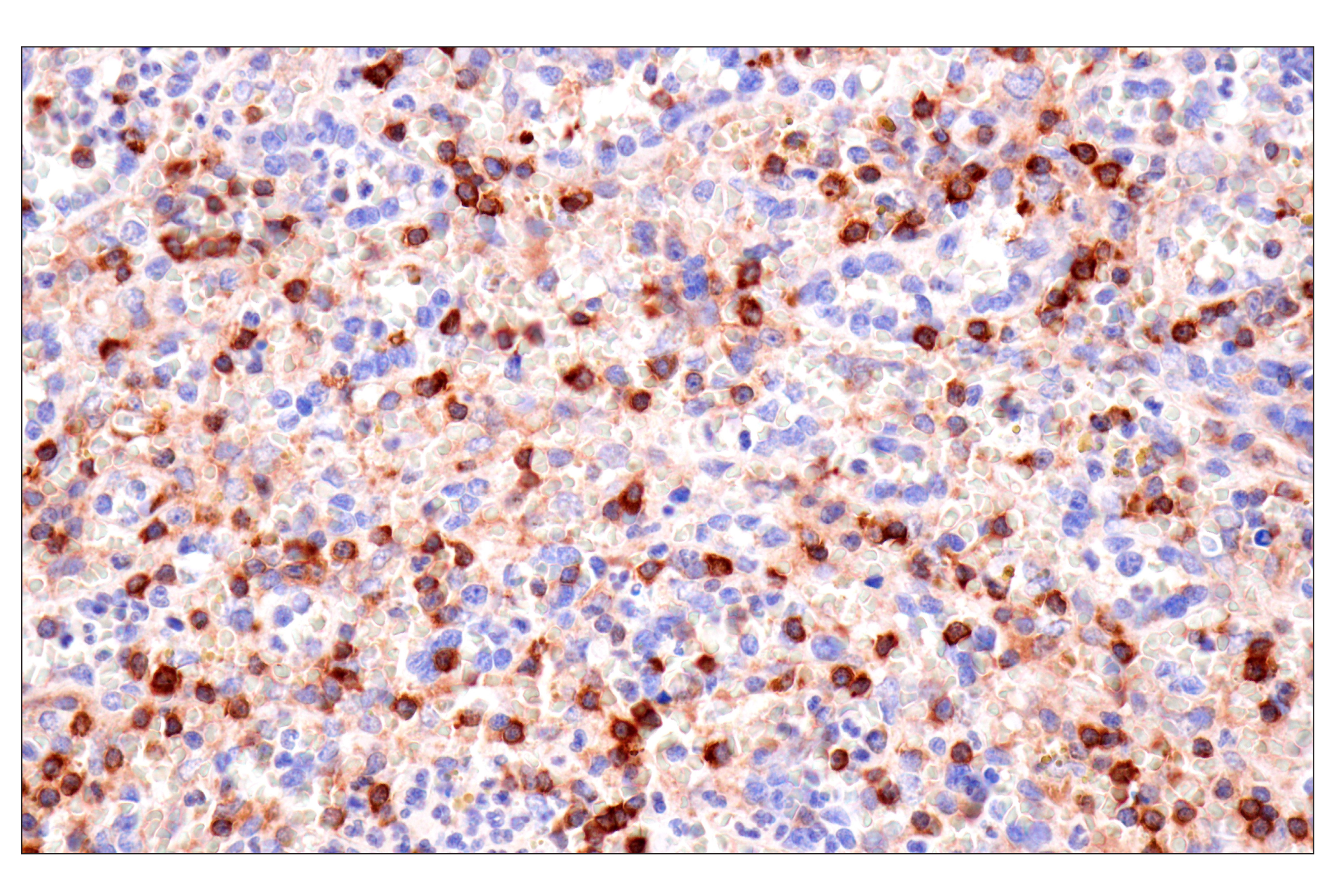 Immunohistochemistry Image 7: SPAK (F7T1K) Rabbit mAb