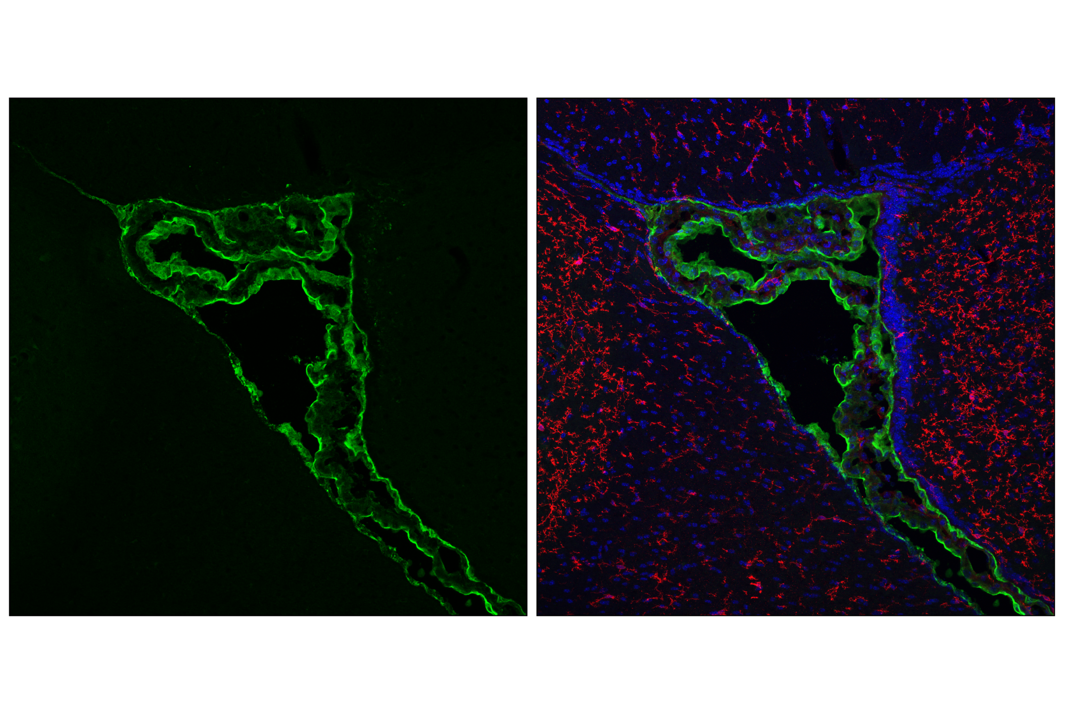Immunofluorescence Image 1: SPAK (F7T1K) Rabbit mAb