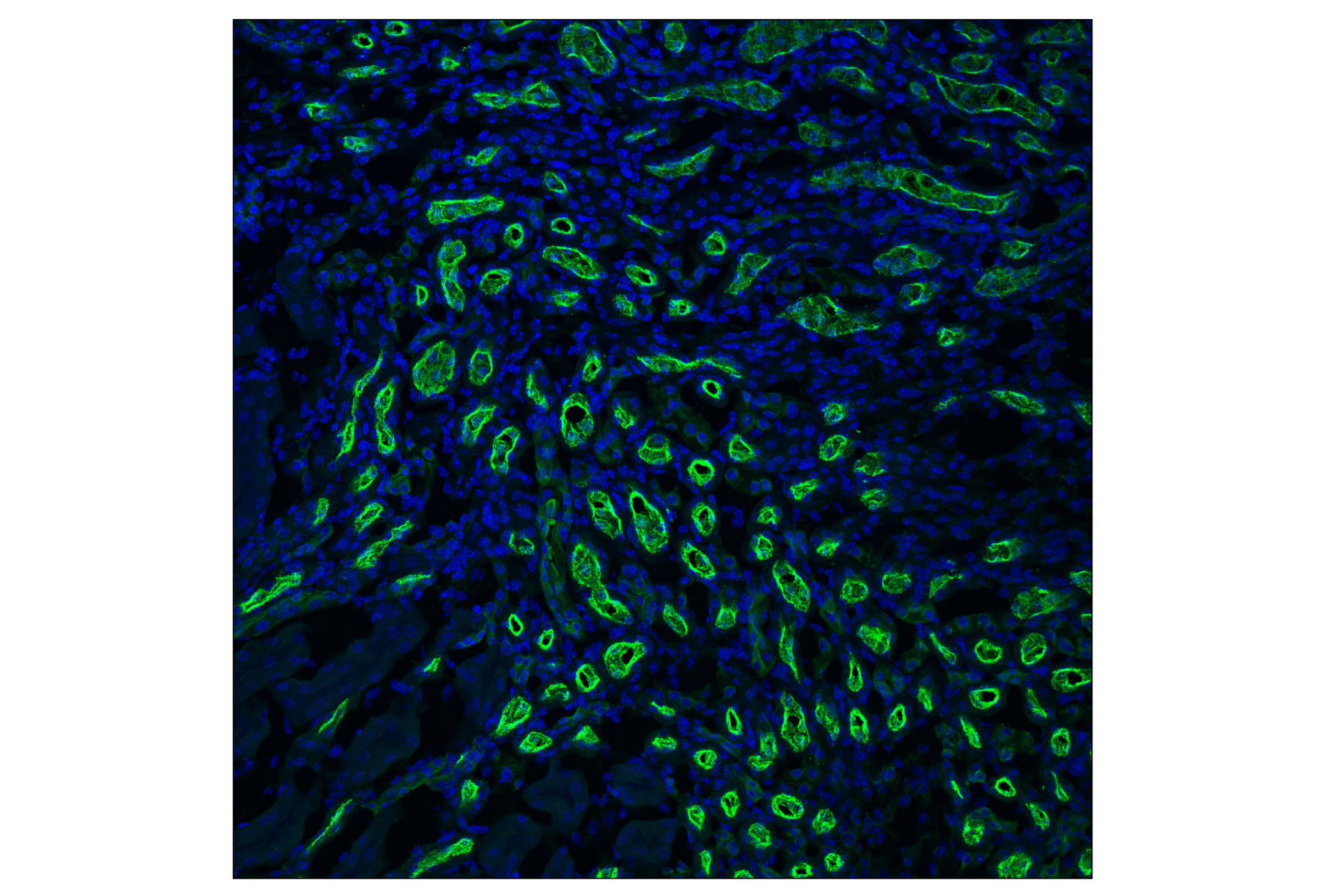 Immunofluorescence Image 2: SPAK (F7T1K) Rabbit mAb