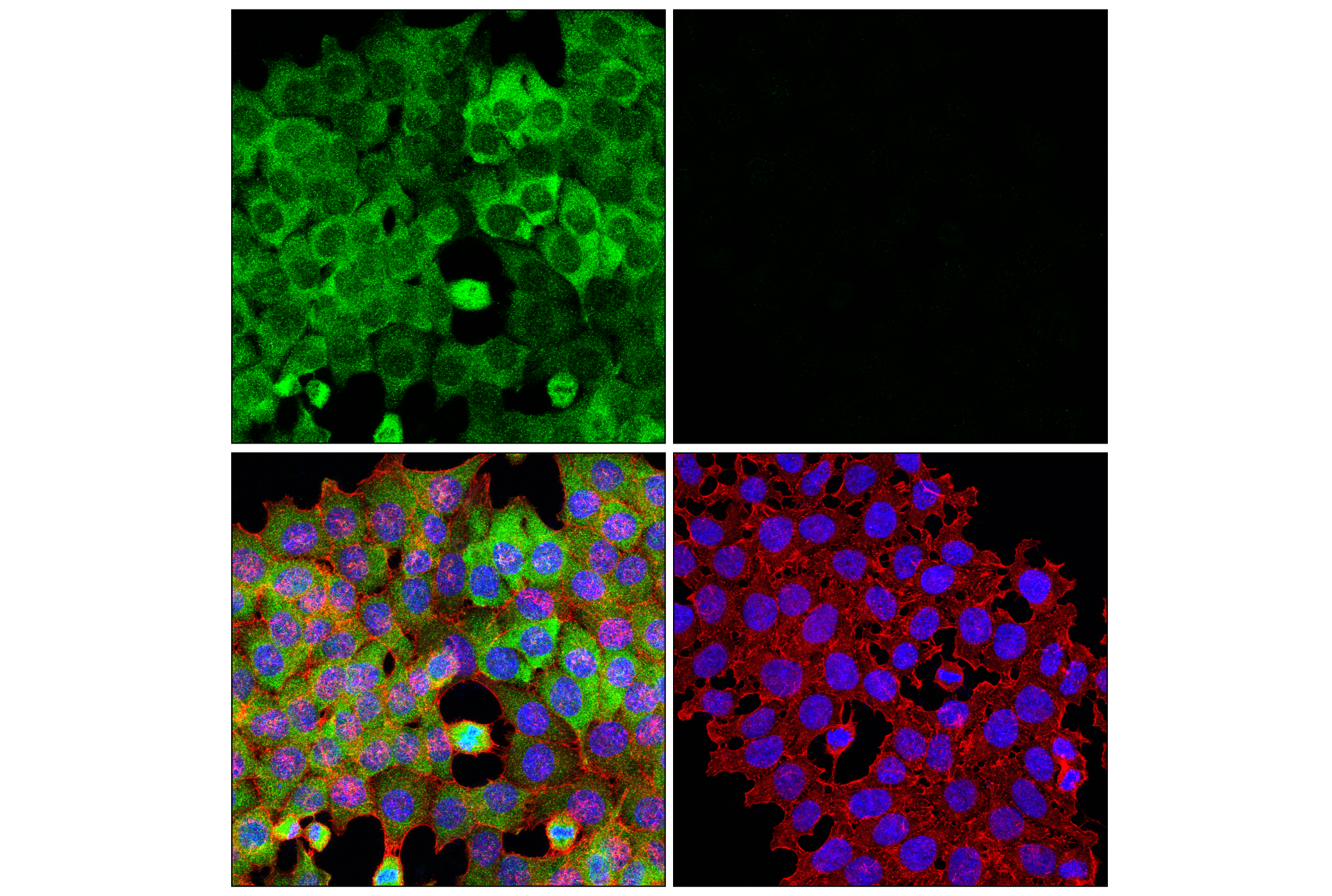 Immunofluorescence Image 3: SPAK (F7T1K) Rabbit mAb