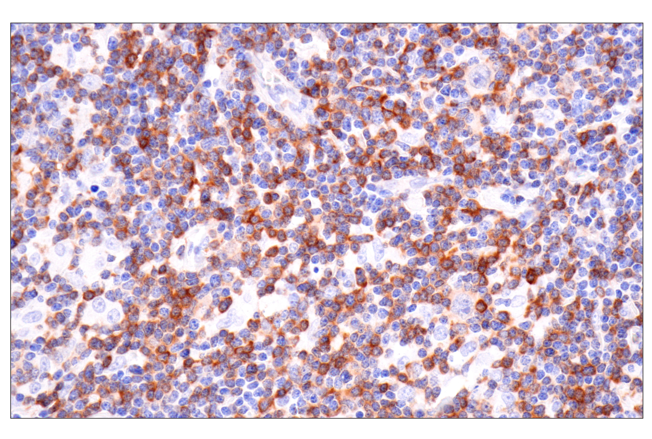 Immunohistochemistry Image 5: SPAK (F7T1K) Rabbit mAb