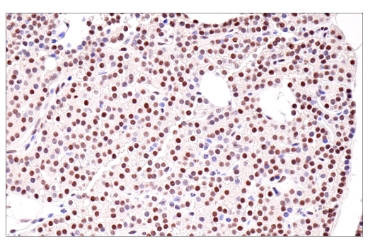 Immunohistochemistry Image 2: SirT1 (1F3) Mouse mAb