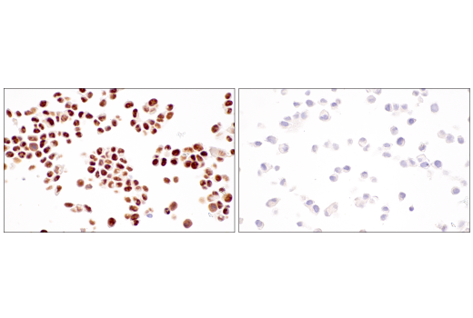 Immunohistochemistry Image 1: SirT1 (1F3) Mouse mAb