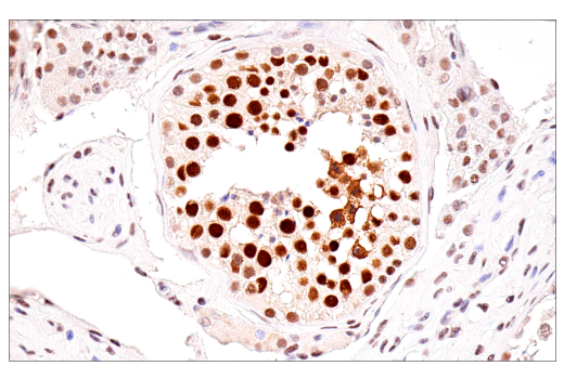 Immunohistochemistry Image 10: SirT1 (1F3) Mouse mAb