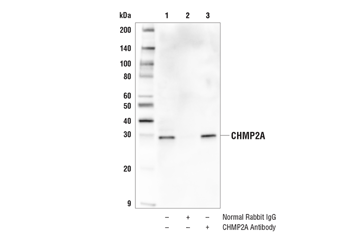 Immunoprecipitation Image 1: CHMP2A Antibody