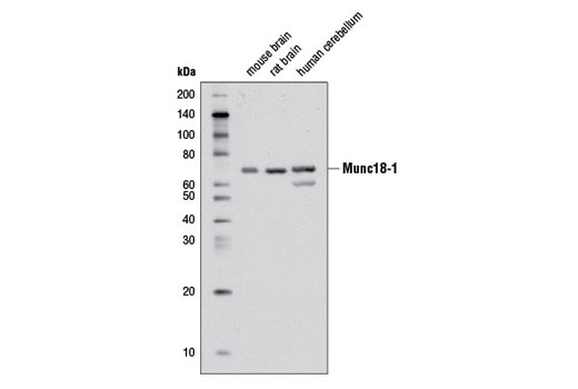 Western Blotting Image 1: Munc18-1 Antibody