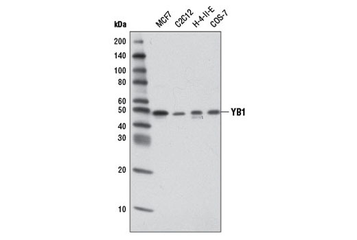  Image 2: PhosphoPlus® YB1 (Ser102) Antibody Duet