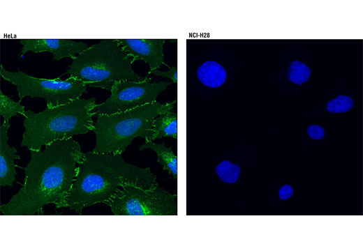 Immunofluorescence Image 2: β-Catenin (D10A8) XP® Rabbit mAb