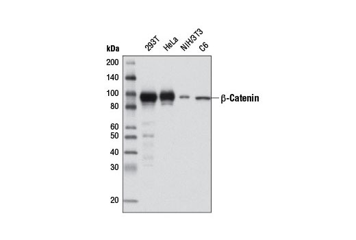  Image 8: PhosphoPlus® β-Catenin (Ser675) Antibody Duet