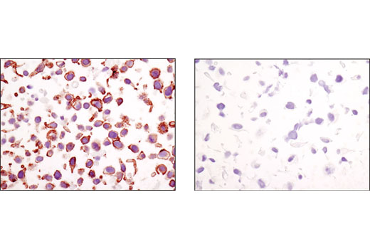  Image 63: Epithelial-Mesenchymal Transition (EMT) Antibody Sampler Kit