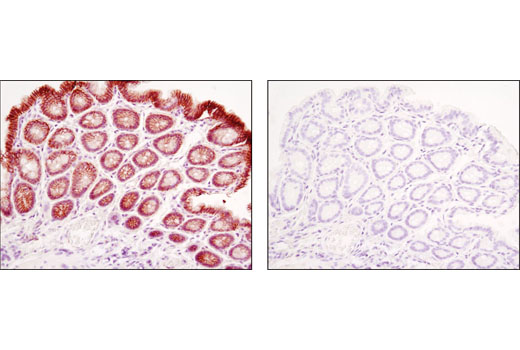 Immunohistochemistry Image 9: β-Catenin (D10A8) XP® Rabbit mAb