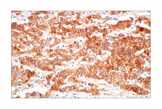  Image 36: Epithelial-Mesenchymal Transition (EMT) Antibody Sampler Kit