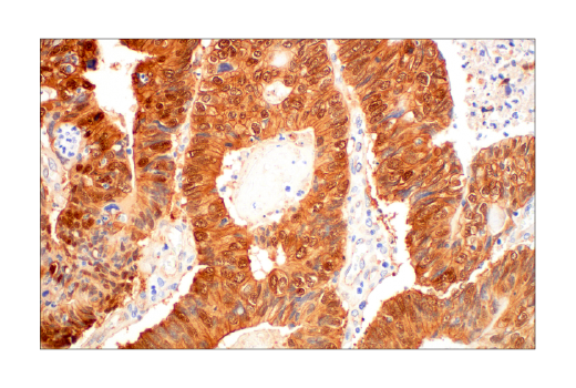 Immunohistochemistry Image 6: β-Catenin (D10A8) XP® Rabbit mAb