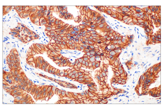 Immunohistochemistry Image 1: β-Catenin (D10A8) XP® Rabbit mAb