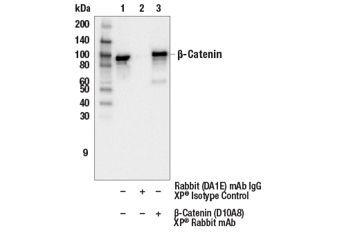 Immunoprecipitation Image 1: β-Catenin (D10A8) XP® Rabbit mAb