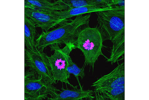 Immunofluorescence Image 1: Phospho-Histone H3 (Ser10) (D2C8) XP® Rabbit mAb (Alexa Fluor® 594 Conjugate)