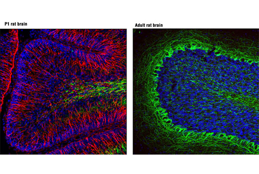 Immunofluorescence Image 1: Nestin (Rat-401) Mouse mAb (Alexa Fluor® 594 Conjugate)