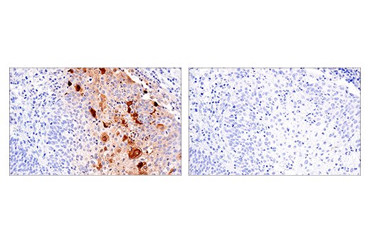 Immunohistochemistry Image 6: S100A7 (E7X2C) Rabbit mAb (BSA and Azide Free)